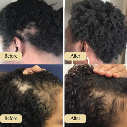 Carvenchy: Your Natural Oil Treatment for Hair Growth